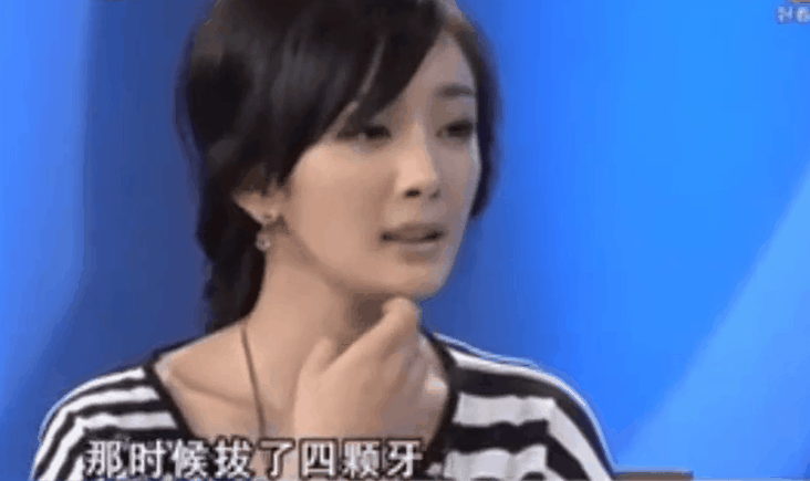 拔智齿可以瘦脸吗?再借杨幂13年前视频科普
