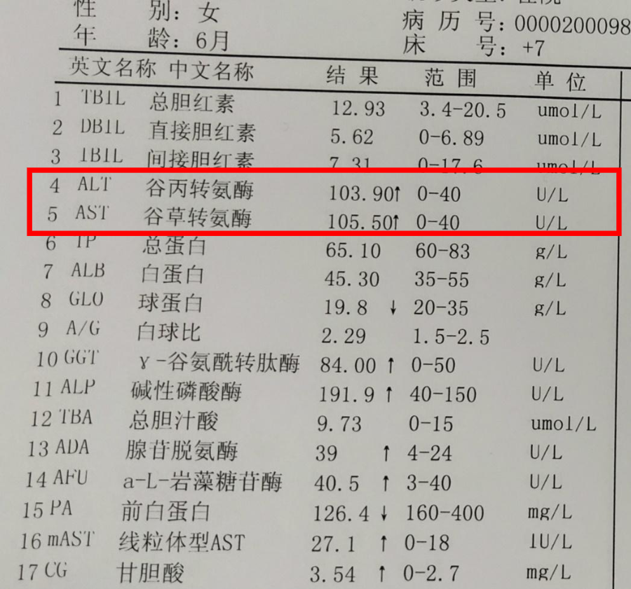 一例异常的肝功,让我认识了川崎病