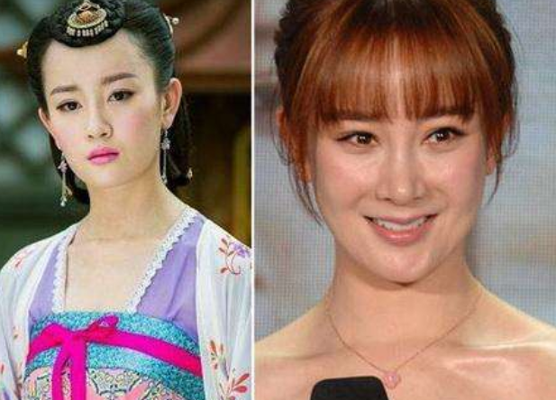 盘点公开承认整容的5个明星,前四个都是变美,而他是为了演戏