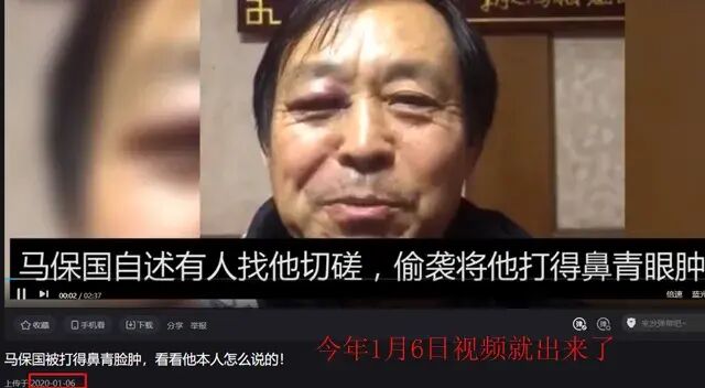 视频中马保国右眼肿胀,陈述着自己被"偷袭"的事情经过.