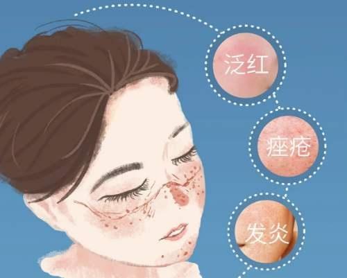 为什么口罩对痤疮和玫瑰痤疮患者这么不友好呢