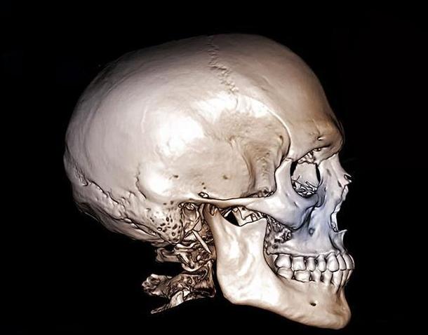 发现30万年前的人类头骨,科学家兴奋不已,能填补进化史的空白吗?