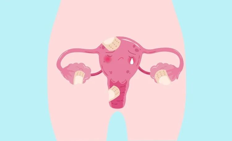 痛经要当心"子宫内膜异位症",很多女性不孕都是因为它