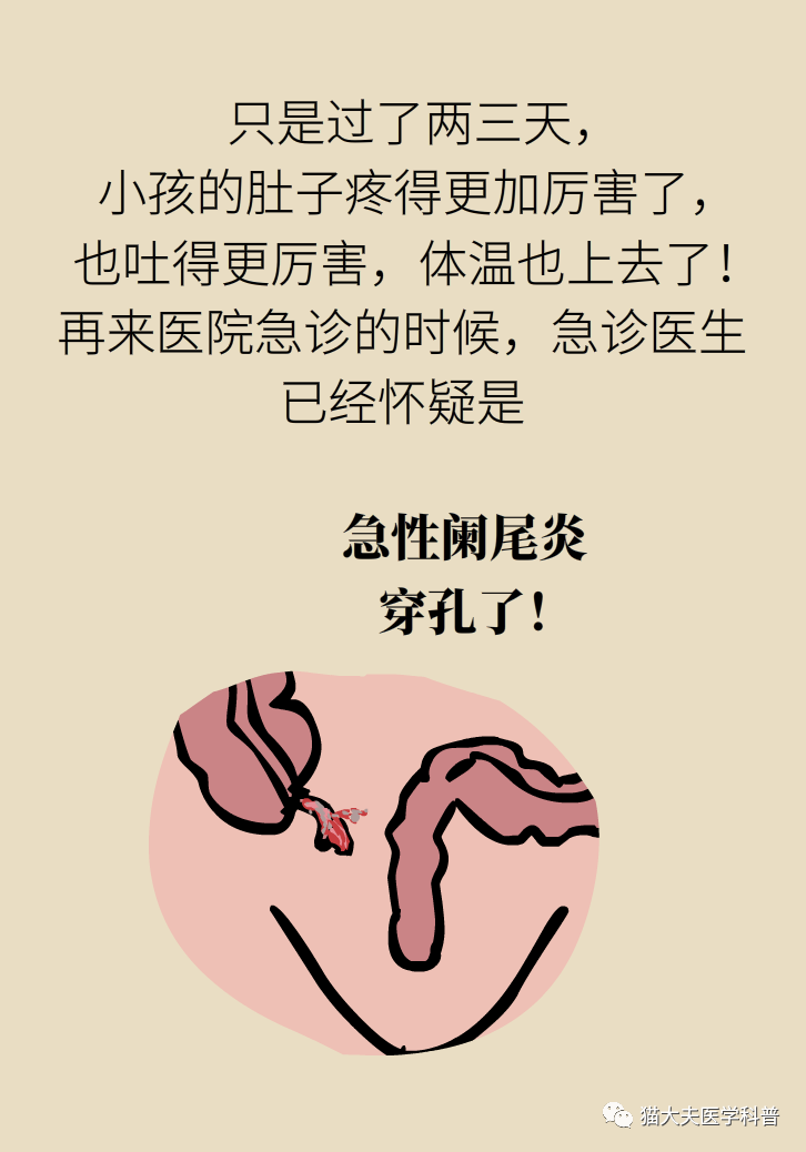 阑尾,复旦大学附属儿科医院,膀胱输尿管反流,心痛,尿道下裂