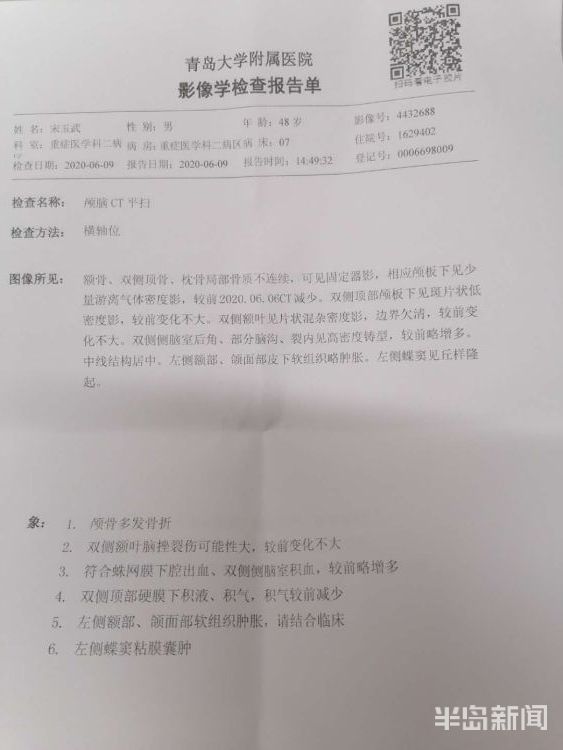 ct影像学检查报告单上看到:颅骨多发骨折,双侧额叶脑挫裂伤可能性大