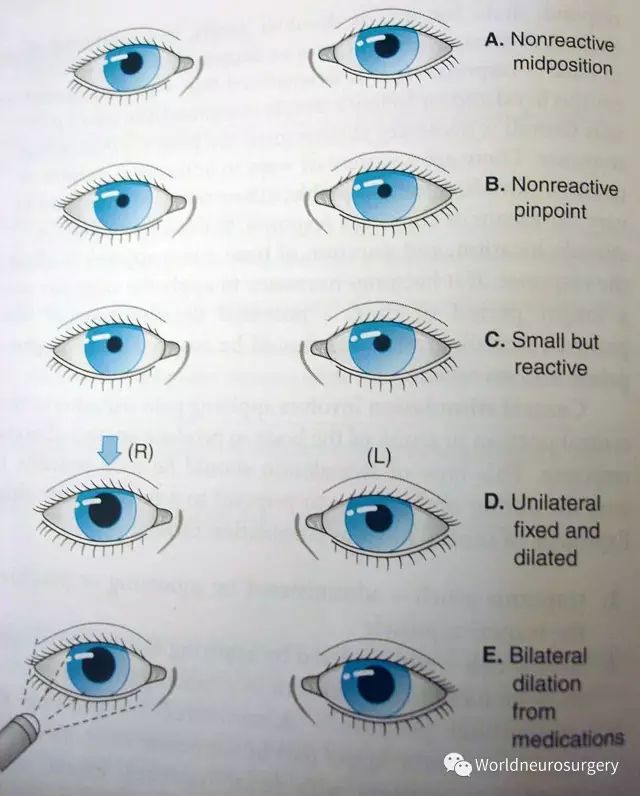 瞳孔的大小受交感与副交感神经的支配.