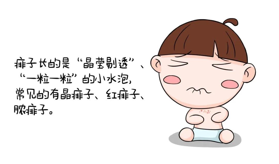 宝宝,痱子,水疱