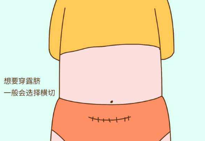 再具体点就是剖腹产依据子宫切口分为:子宫体纵切口和子宫下段横切口