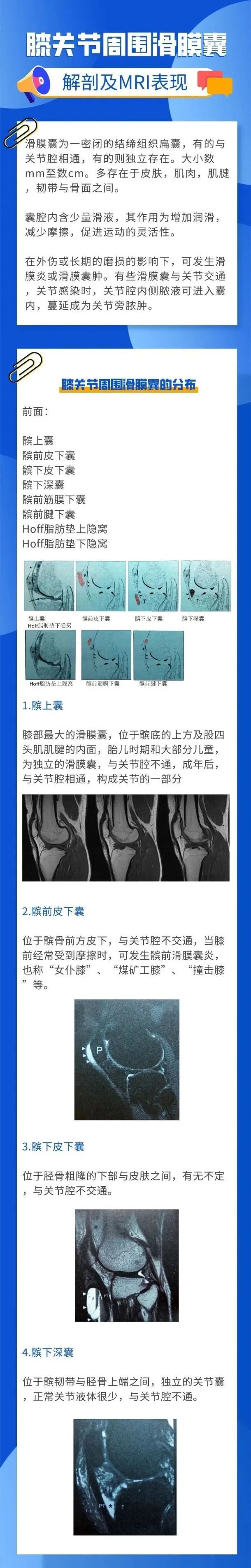 认识膝关节周围滑膜囊
