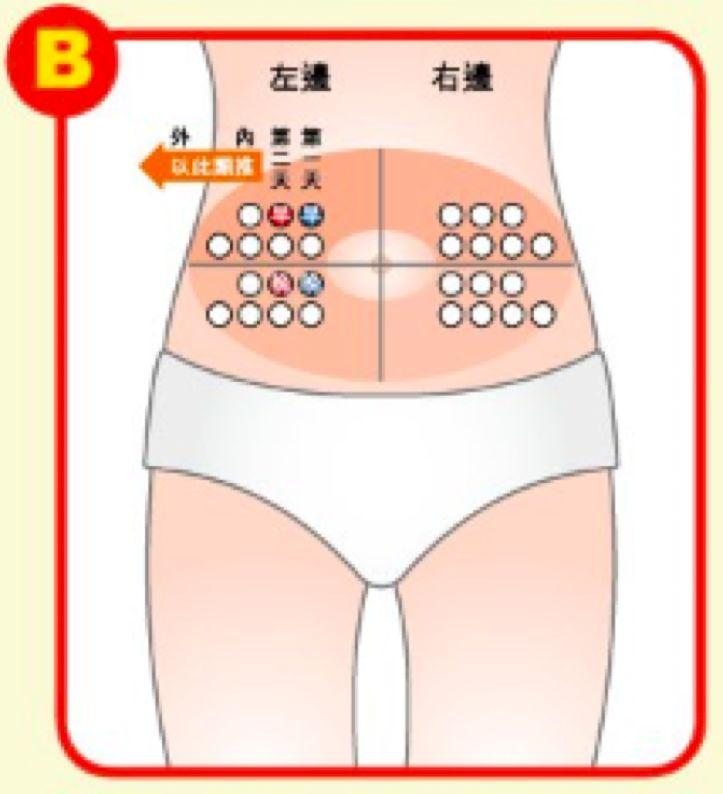 胰岛素,血糖,胰岛素类似物,腹部