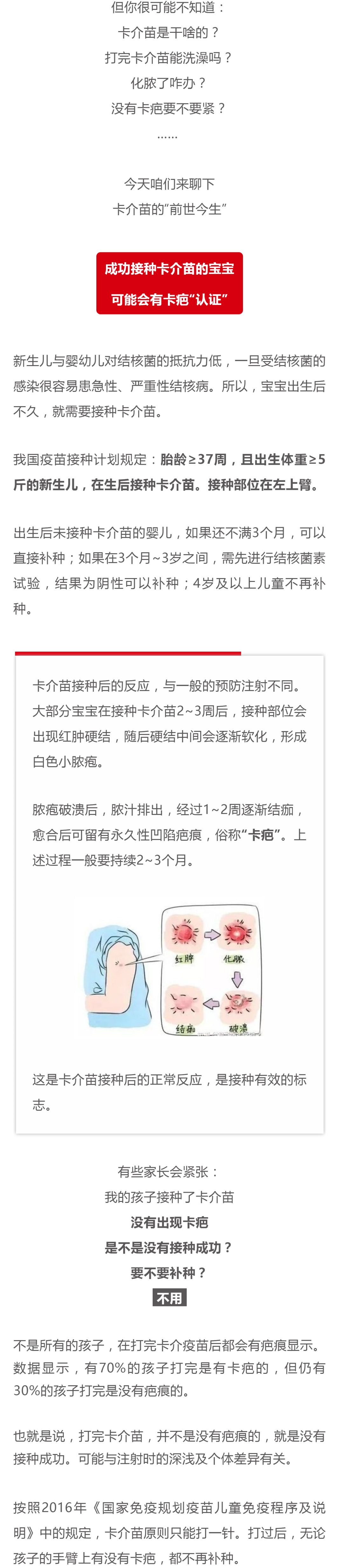 宝宝接种卡介苗后有这些情况得赶紧送医院
