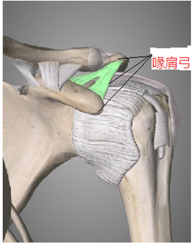 常见是肩峰撞击