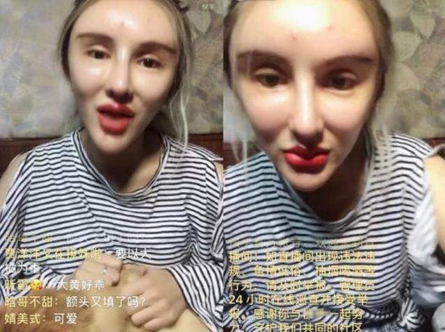 从16岁开始整容的红粉宝宝,花四百多万整二百余次,如今怎样了