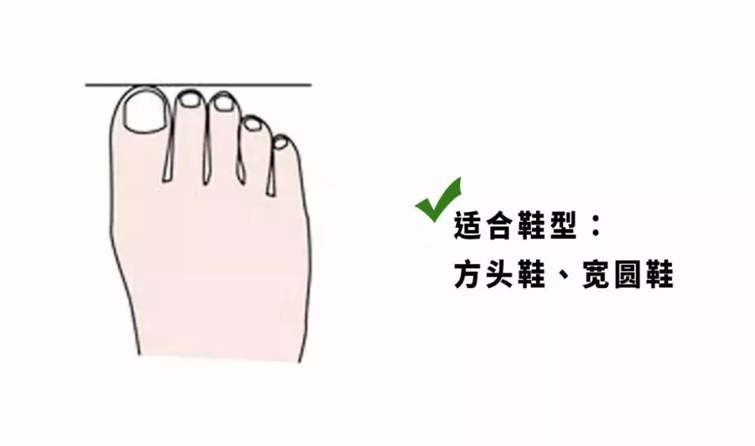 罗马脚