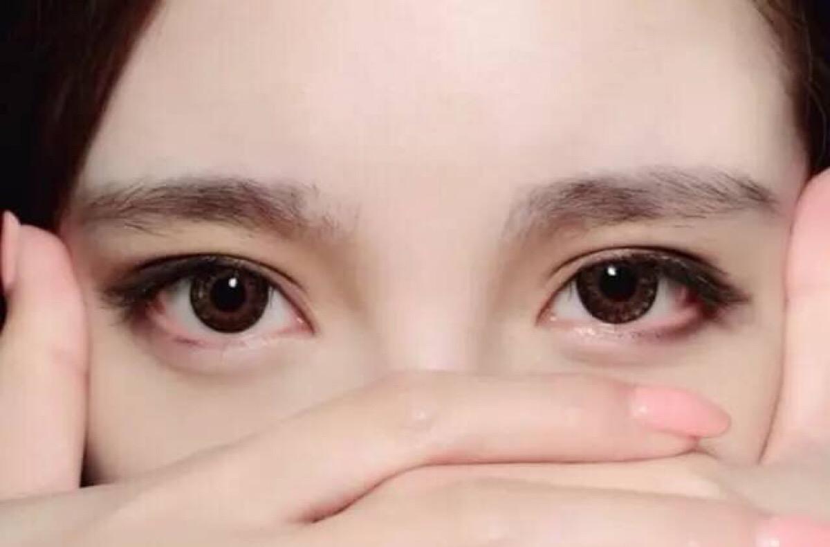 近视眼可以割双眼皮吗?之后对佩戴眼镜有什么影响