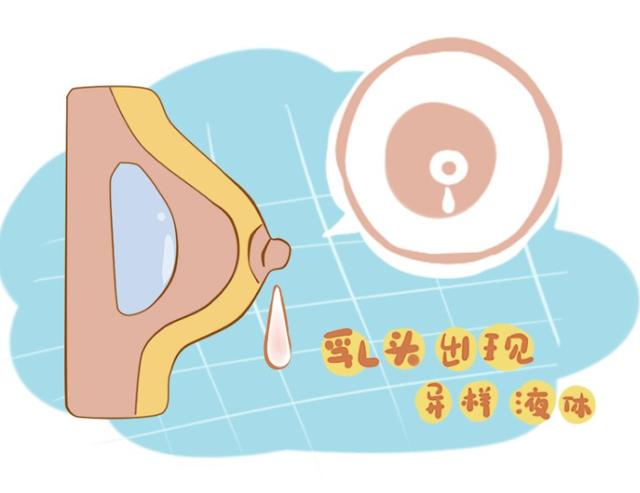 乳腺结节会癌变吗?肿瘤医生:乳腺出现四种表现要当心!