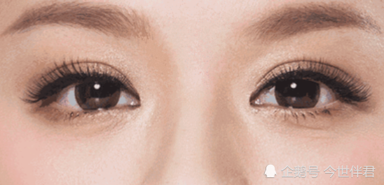 为什么亚洲人多数是"单眼皮",而欧美人却在双眼皮数量