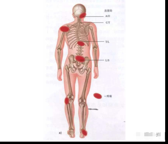 比如我们现代人最常见的腰痛,很多都是腰部肌肉劳损造成的.