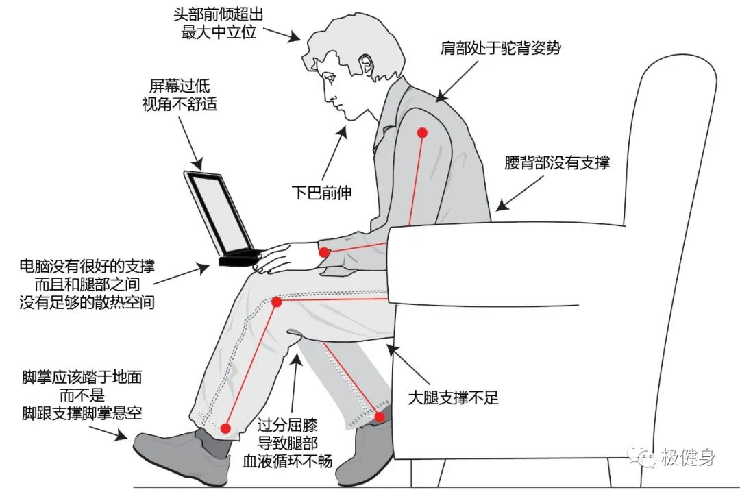 健身,矫正,上交叉综合症,肌肉,运动