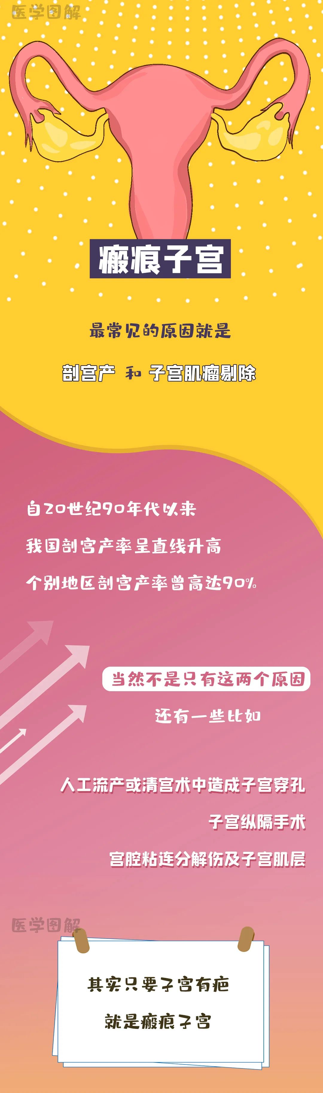 瘢痕子宫,隔多久再怀孕最好?