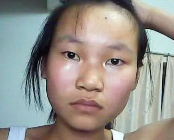 青春期女生
