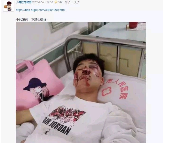 鼻青脸肿!后仰跳投坠楼男生医院床照曝光,看衣服就知道是老后卫