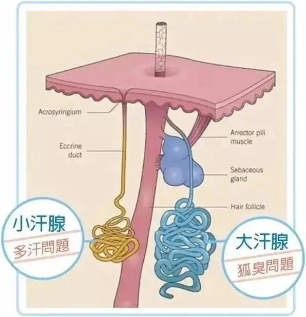 人体汗腺包括小汗腺和大汗腺,小汗腺太活跃就会分泌过多的汗液,变"