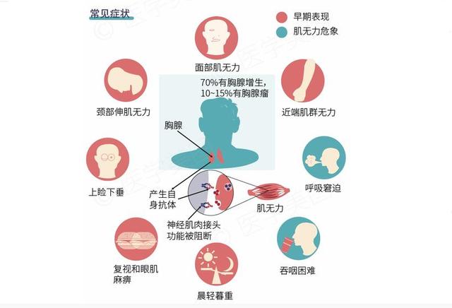 重症肌无力患者怎样饮食才合适呢?—北京崇文门痿症科