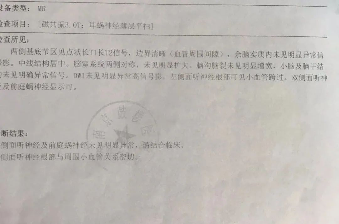 警惕:新生儿听力筛查通过≠听力没问题!