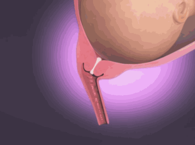 同样的胎儿从妈妈肚子里生出来也不是一个简单的过程,那么分娩的过程