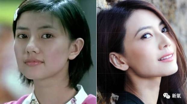 高圆圆一夜变美,是颧骨内推还是自然衰老的关键分析!