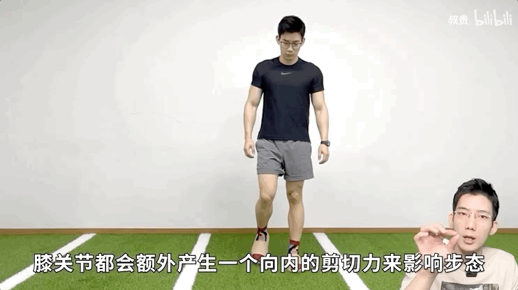 相当于,每次走路膝关节都会额外产生一个向内的剪切力来影响步态.