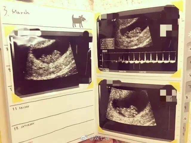 张子萱怀孕日记曝光，却被网友找出好多错别字