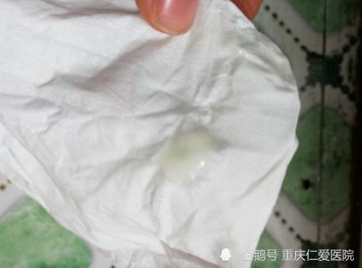 白带异常的症状,治疗白带异常,重庆妇科医院