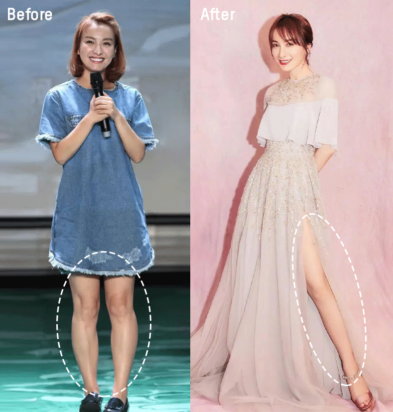 吴昕的穿搭路是开了什么窍从时尚黑洞变成了洋气少女真绝了