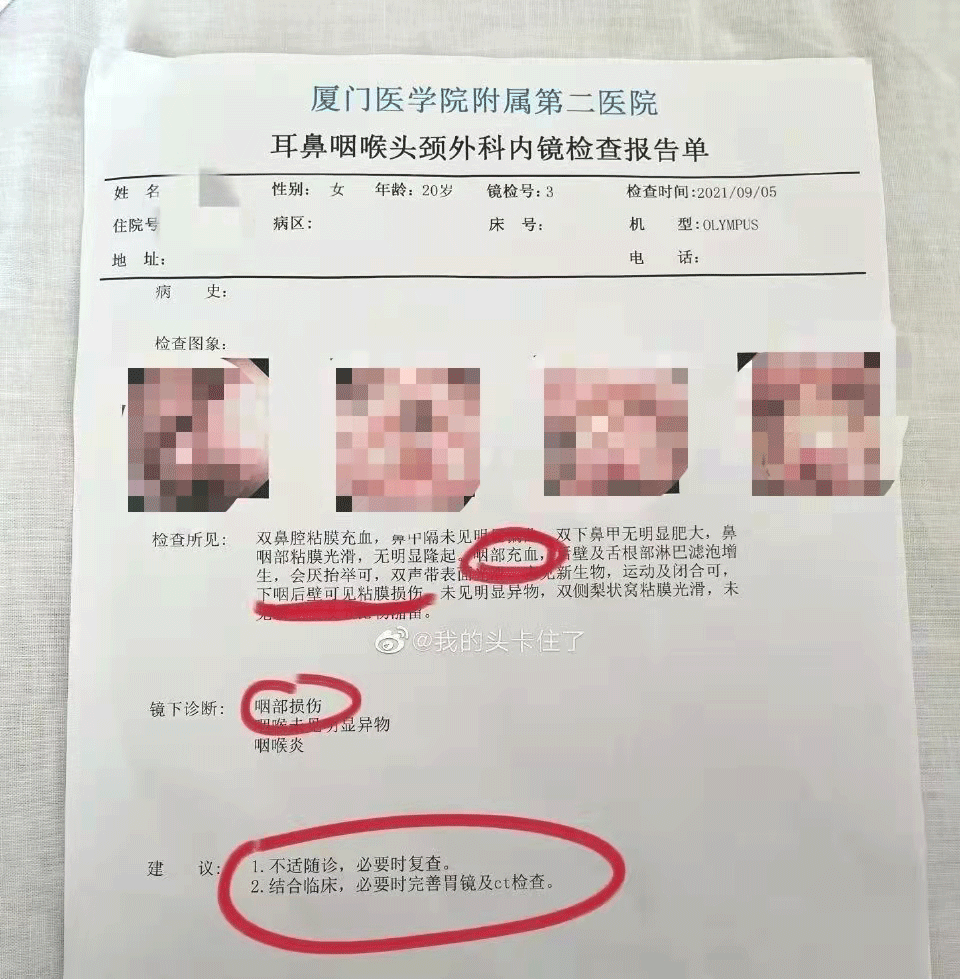 网友震怒厦门女孩吃外卖咳出血更无语的是