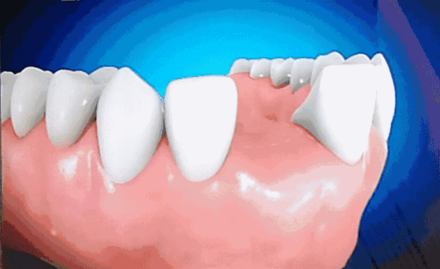 羡慕别人80岁还有一口好牙那就快收好口腔专家的这些建议