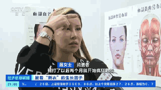 央视曝光:女子美容院花6万多注射生长因子,一年后竟变成"长方形脸"