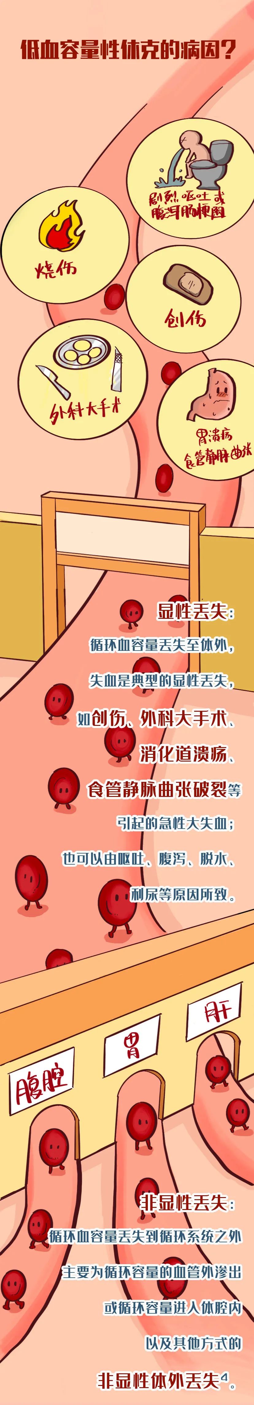 低血容量性休克一图带你读懂
