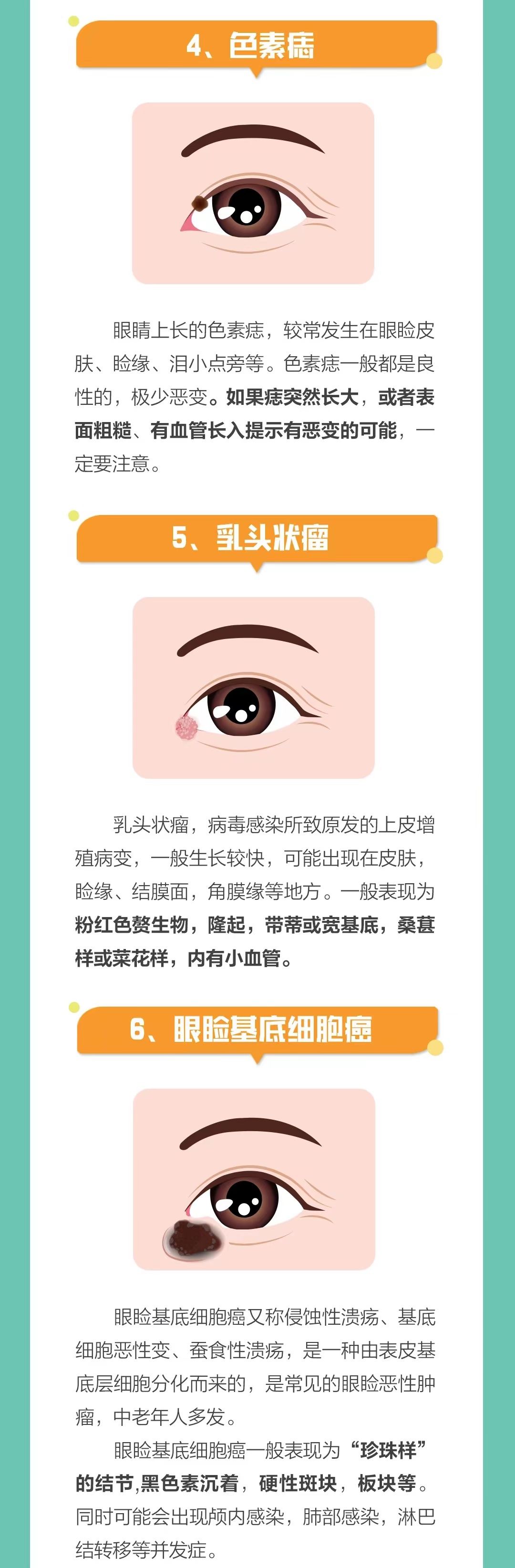 今天我们聊一聊#眼脸肿物#眼睑俗称眼皮,眼皮会长哪些肿物呢?