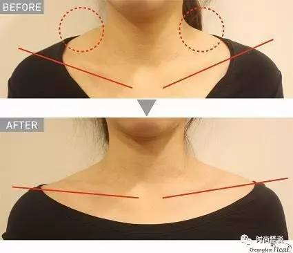 又被造型师坑,张子枫这斜方肌也太夸张了!