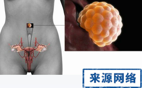 广州17岁少女被忽悠1.5万卖卵子 卵巢破裂险丧命