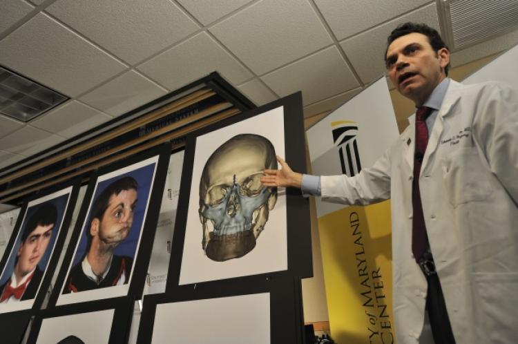 斥资千万美元，全球首例换脑手术将展开(图)