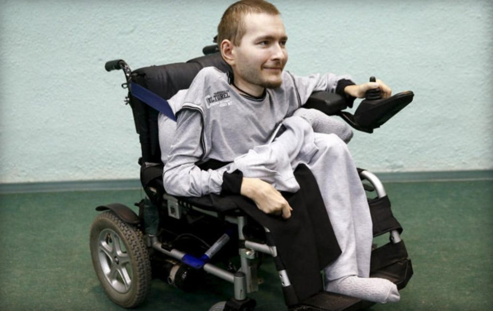 斥资千万美元，全球首例换脑手术将展开(图)