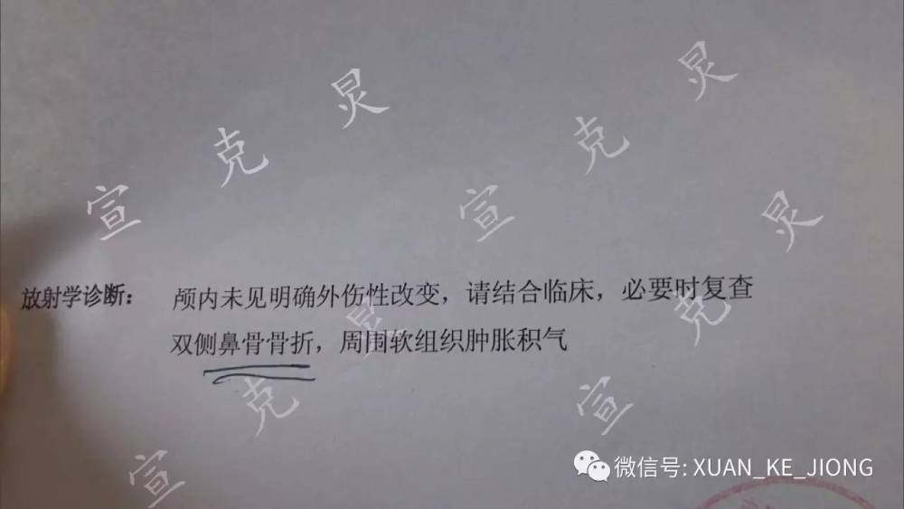 汤姆熊事件:疑排队纠纷碰擦孩子夫妻打人