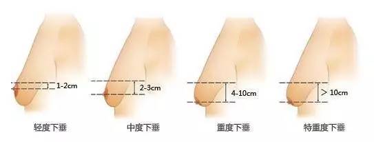 杨幂胸变大、小肚子明显,难道是怀二胎了?