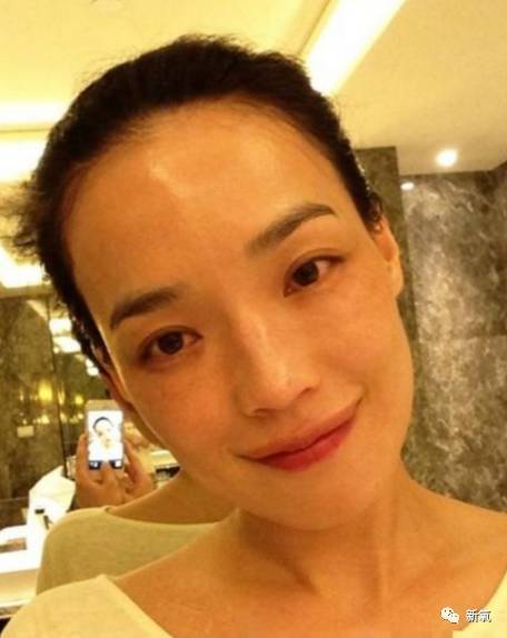 林允倪妮舒淇这类鲶鱼脸其实是种面部发育缺陷