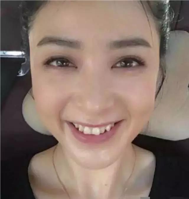 不错,就是牙齿,参差不齐,尤其是笑起来的时候严重的影响整体的美观