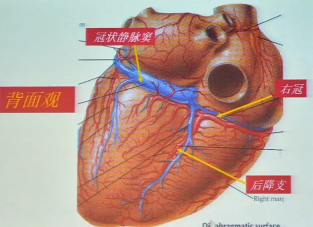 右冠状动脉(rca)开口于升主动脉右前方的右冠窦,供应右心房,右心室前