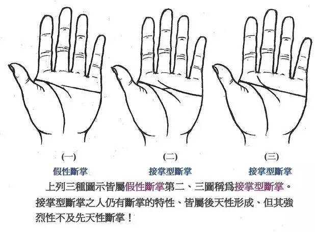 所谓断掌,是智慧线和感情线相交,从手掌的一端至另一端,成一直线